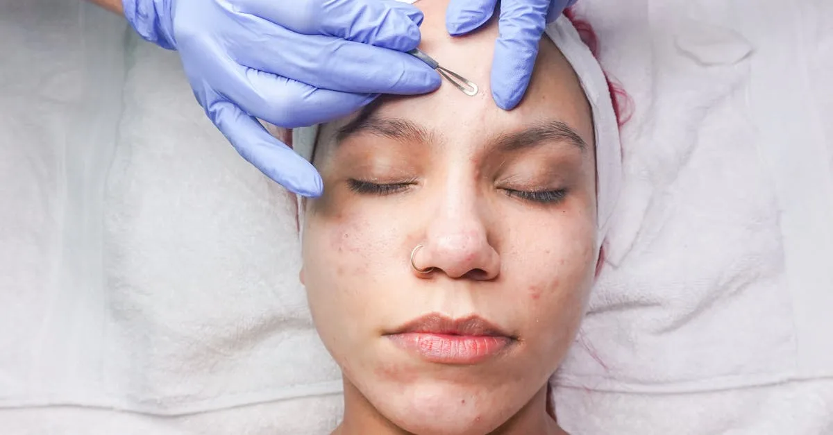 découvrez les meilleurs traitements pour les morsures de brochet : conseils, soins immédiats et prévention des infections.